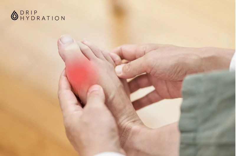 Chỉ số Axit Uric cao cảnh báo dấu hiệu của bệnh gout
