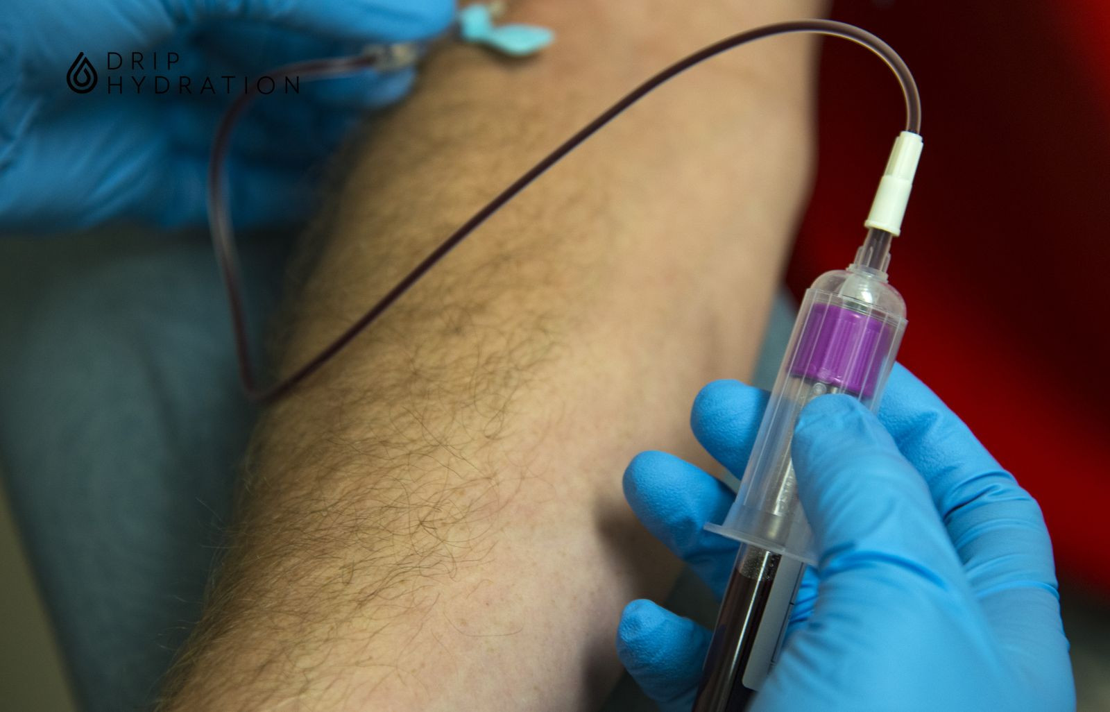 Các xét nghiệm lupus ban đỏ là cơ sở để lựa chọn phương pháp điều trị phù hợp nhất