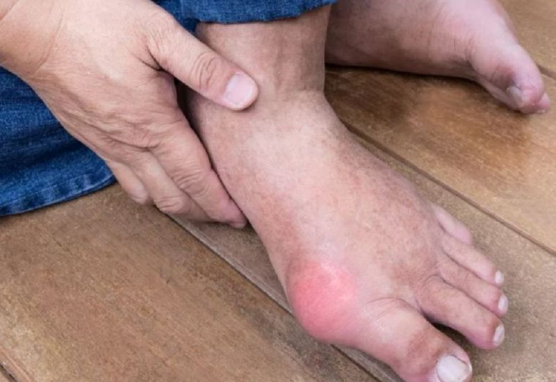 Chỉ số axit uric giúp đánh giá tình trạng bệnh gout, sỏi thận...