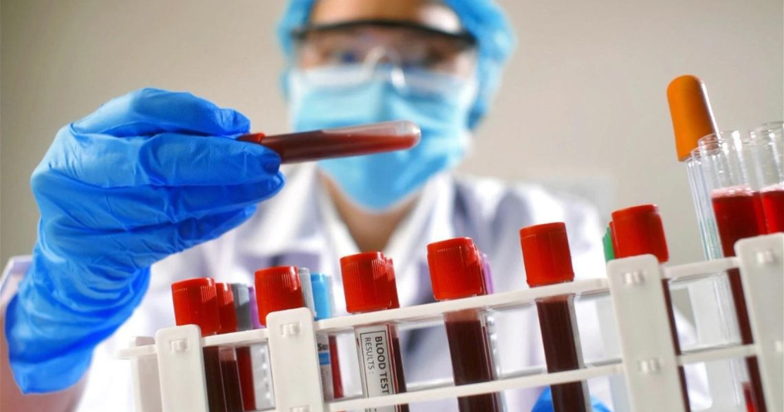 Blood tests from basic to advanced