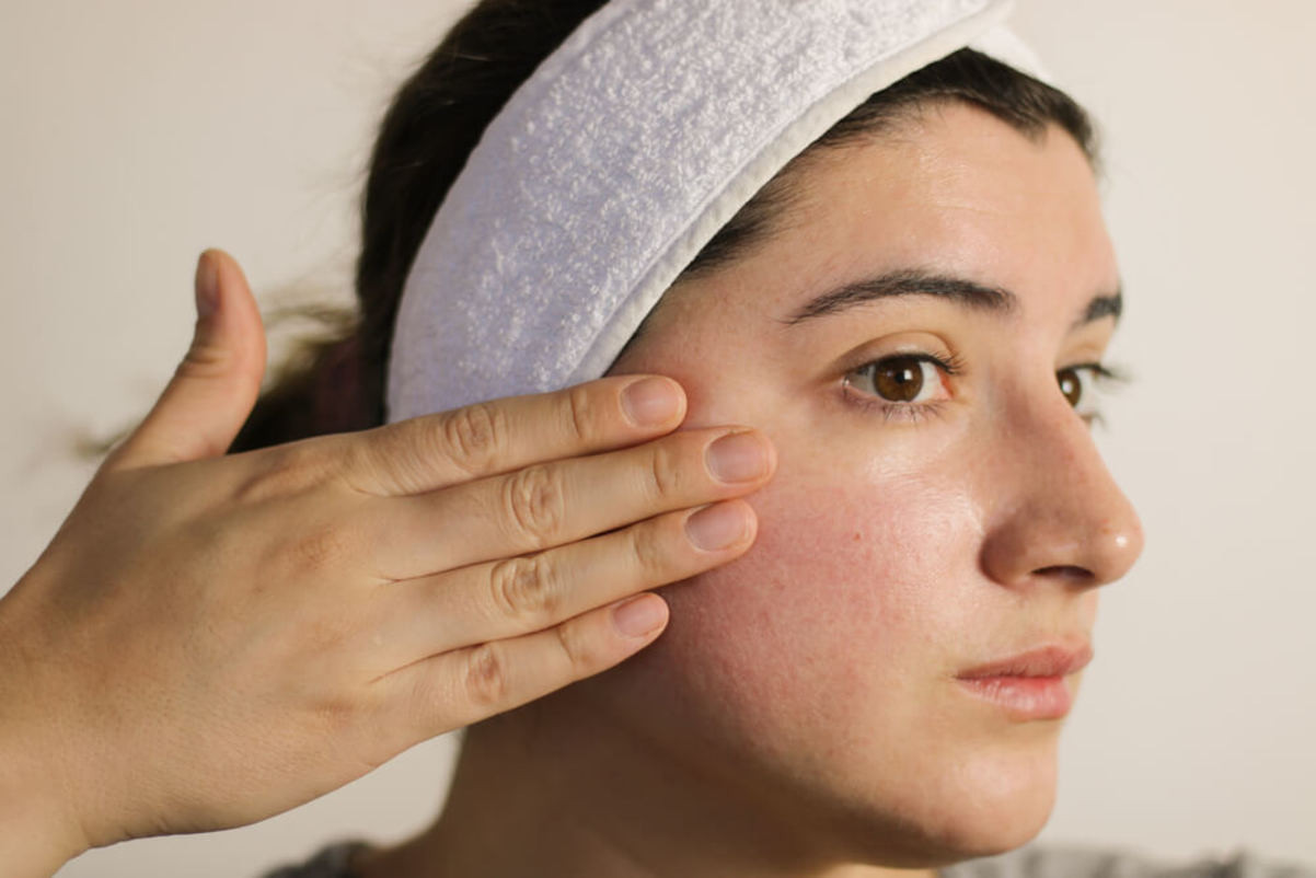 How to recover from severe corticosteroid-damaged skin? How long will it take?