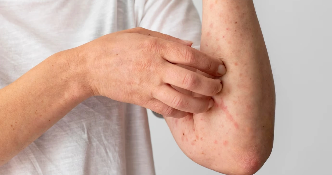 Is it dangerous to have an allergic reaction after taking weight loss pills?
