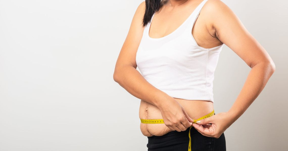Is rapid weight loss after childbirth considered postpartum?