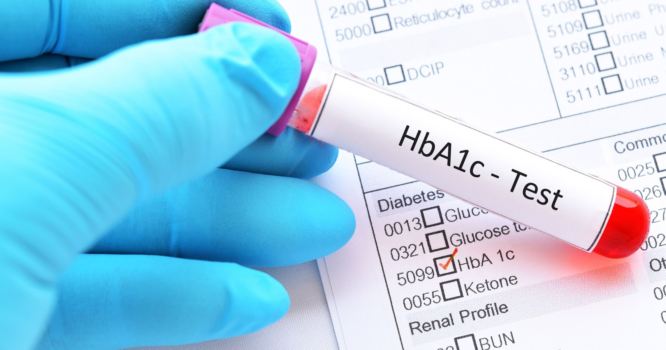 Is an HbA1c level of 7.2 indicative of diabetes?