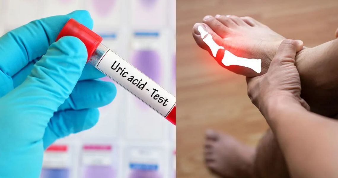 Is a uric acid level of 600 high or low? Is it dangerous?