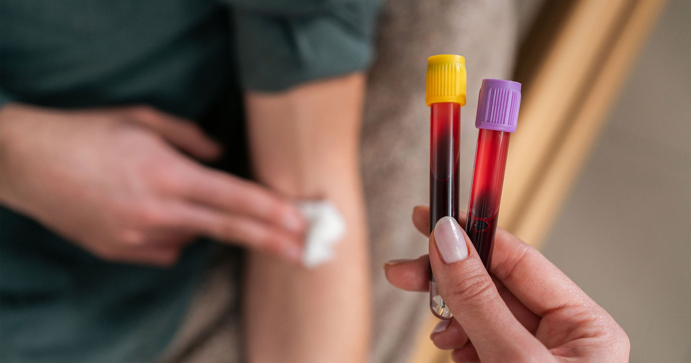 Is a blood uric acid level of 480 low or high? Has a uric acid level of 480 caused gout?